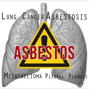 Asbestos