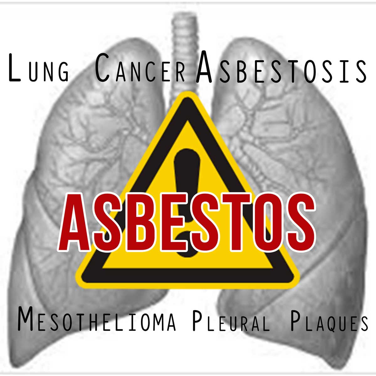 Lung Cancer Asbestosis