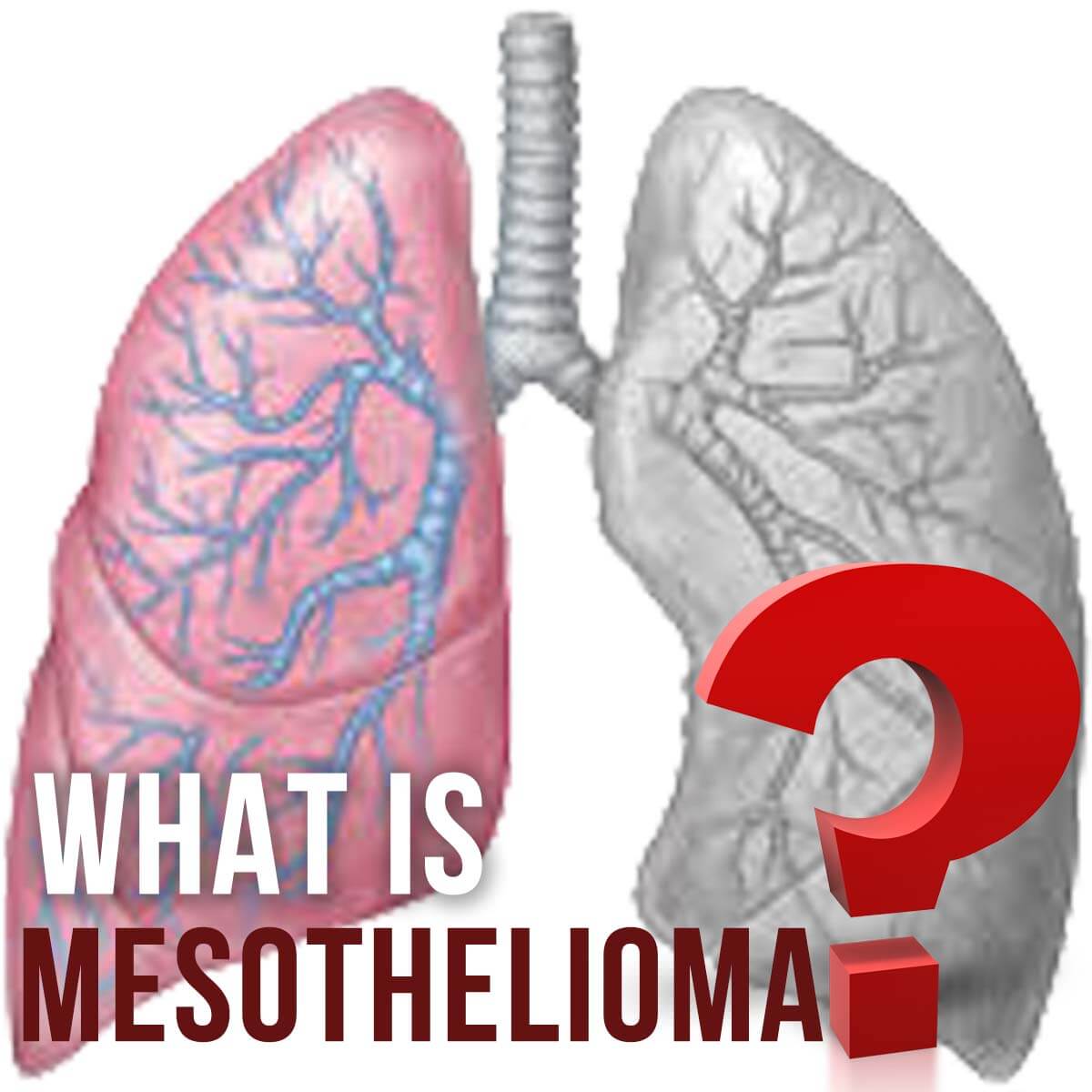 mesothelioma trial lawyers