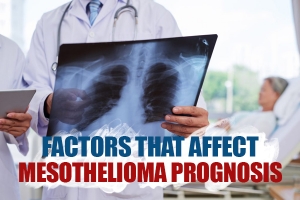 Factors That Affect Mesothelioma Prognosis