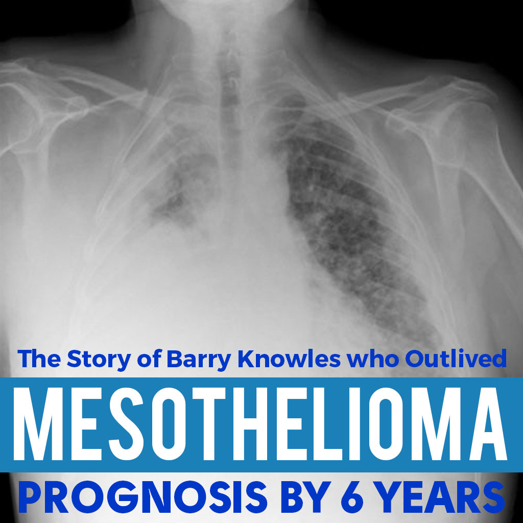 The Story of Barry Knowles who Outlived Mesothelioma Prognosis by 6 Years