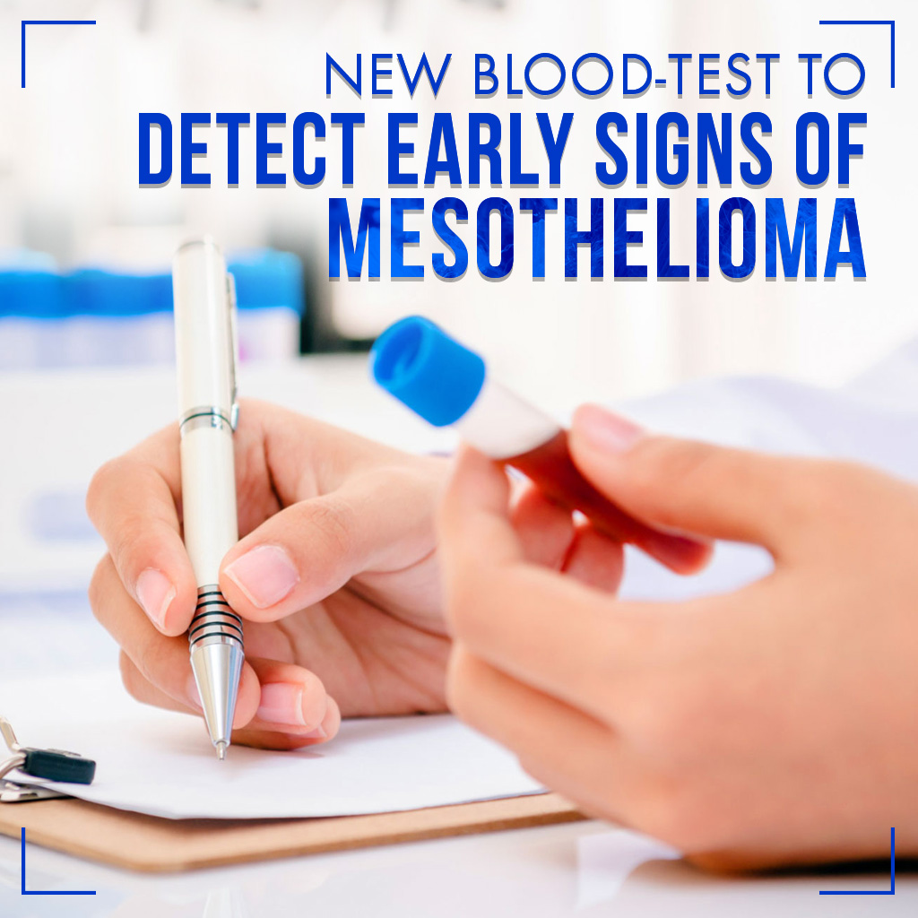 New Blood Test to Detect Early Signs of Mesothelioma