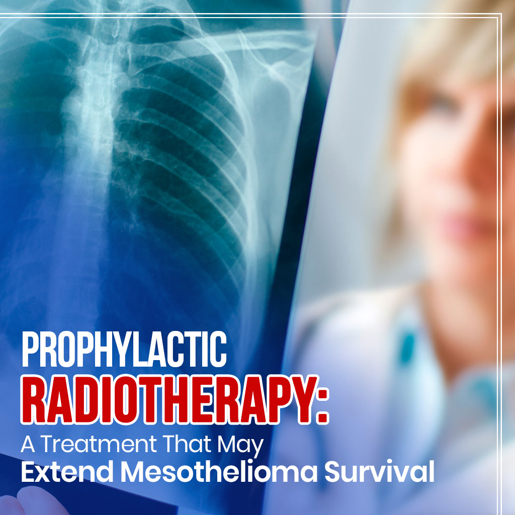 Prophylactic Radiotherapy: A Treatment That May Extend Mesothelioma Survival